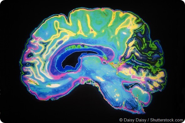 @Artificially Colored MRI Scan Of Human Brain