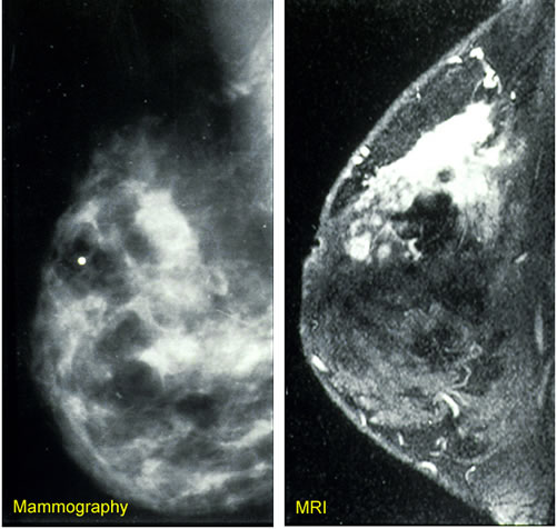 Example breast imaging technology