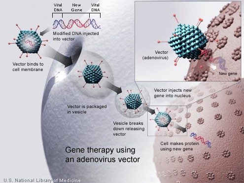 Gene therapy using an adenovirus vector