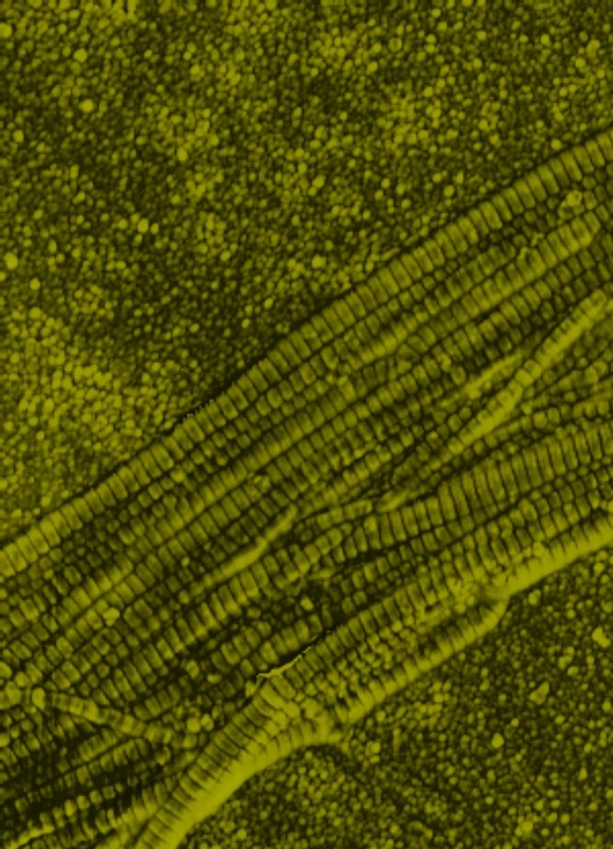 Image of collagen fibrils