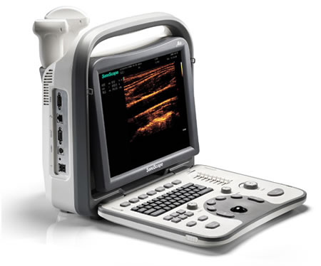 Sonoscape A6 Portable Ultrasound Machine from SonoLogic