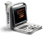 Sonoscape A6 Portable Ultrasound Machine from SonoLogic