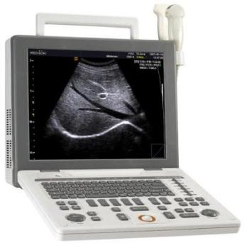 SonoAce R3 Ultrasound Machine from Samsung