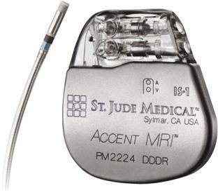 Accent MRI Pacemaker from St. Jude Medical