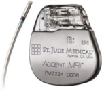 Accent MRI Pacemaker from St. Jude Medical
