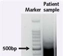 Chromatrap Immunoprecipitation Assay Enriches Epigenetic Histone Methylation Marks from Primary Biopsy Samples