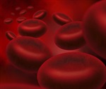 GlobalData: Hematology tests can be a prognostic marker to predict severity of COVID-19 patients