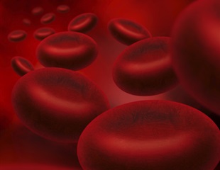 PREACH-M trial: Lenzilumab may improve treatment response in chronic myelomonocytic leukemia