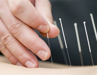 Acupuncture significantly improves lower back or pelvic pain during pregnancy