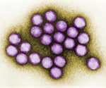 Four mild forms of adenovirus cases at Voorhees Pediatric Facility under control and no new cases reported