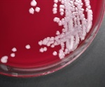 New research may help prevent anthrax, bubonic plague and typhoid fever