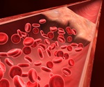 Vein-on-a-chip model can help understand the mechanisms of blood clot formation