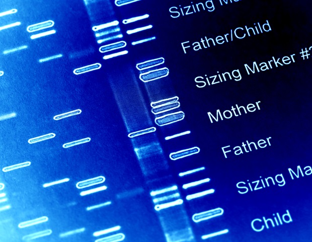 Genetic cause of lupus identified – News-Medical.Net