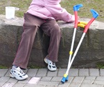 Knee osteoarthritis (OA) is a leading cause of disability in the elderly