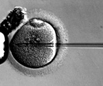 New approach could treat infertility caused by abnormal GnRH secretion