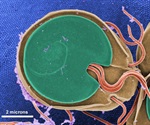 UEA researchers unravel secret behind success of giardia parasites