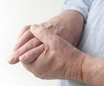 Study: Nurse-led care can be more successful in managing gout