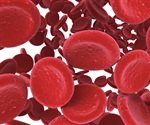 Study to restrict hemoglobin-based oxygen carriers