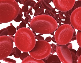 Researchers develop proof-of-concept treatment for blood disorders