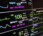 AI-based system for real-time prediction of complications in intensive care units