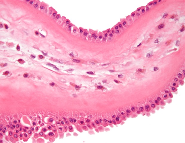 Photo of Phénotype de macrophage spatialement résolu dans la recherche sur les maladies du foie