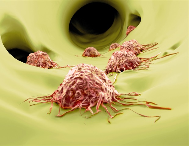 Study uncovers new regulator of prostate cancer metastasis – News-Medical.Net