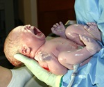 Temporal artery thermometer measures newborn body temperature more precisely