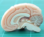 Research reveals mechanism underlying Parkinson's dyskinesia