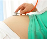 Study: Race and ethnicity did not affect pregnancy and birth outcomes in women with COVID-19