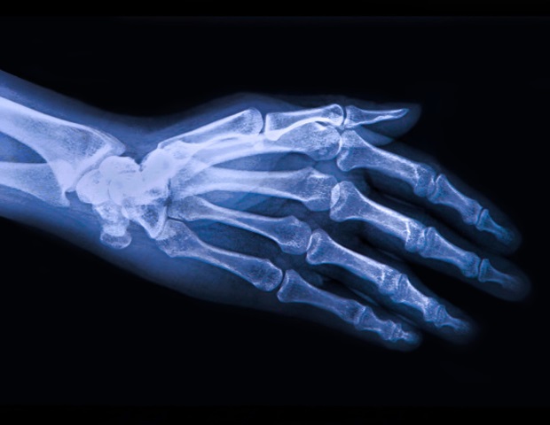 artralgie alle mani unguent eficient pentru artrita genunchiului