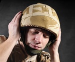 Veterans with extreme mixed handedness and high combat exposure five times more likely to have PTSD