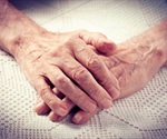 Chondroitin sulfate decreases pain and improves hand function in patients with OA