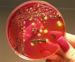 Scientists take another step in understanding bacteria that cause Salmonella epidemic