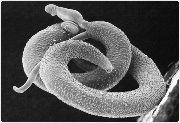Schistosoma mansoni is a significant parasite of humans, a trematode that is one of the major agents of the disease schistosomiasis.