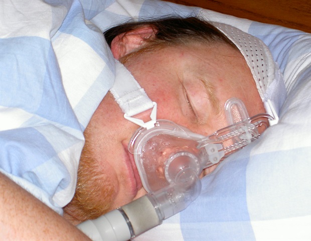 Study explores the link between sleep apnea and brain volume