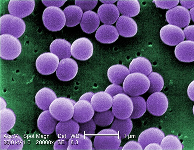 Staphylococcus Aureus Treatment