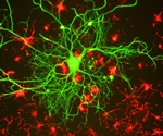 Study shows how tau protein, critical to Alzheimer's, turns from normal to diseased state