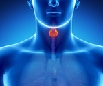 Pazopanib shows promise for aggressive thyroid cancer