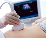 Ultrasound treatment to boost sperm motility could increase a couple’s chances of conceiving