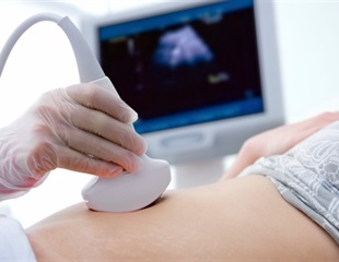 UNC study introduces a novel opportunity to democratize obstetric ultrasound