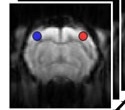 Functional Connectivity Magnetic Resonance Imaging of the Rat Brain