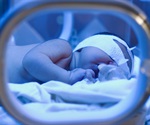 Researchers develop first wearable device to precisely monitor jaundice in newborns