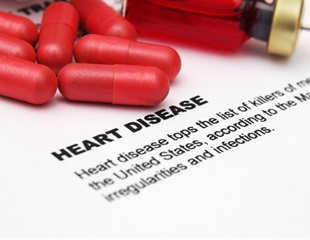 One-third of adults in the U.S. with Type 2 diabetes may have symptomless cardiovascular disease