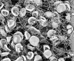 Phenom Scanning Electron Microscope Accelerates Blood Clotting Research