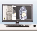 SKYSCAN 1275 provides high quality 3D images by highly automated, self optimizing, micro-CT