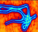 Biocartis to develop Rapid Ebola Virus Triage Test