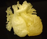 3D printed heart models to aid doctors plan for complex ops'