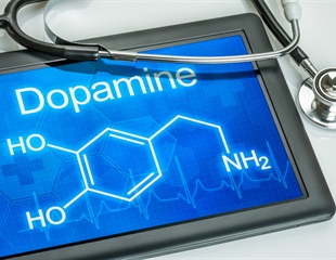 Study finds distinct differences in how the brain releases dopamine in patients with alcohol use disorder