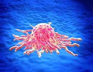 Pembrolizumab in combination with chemotherapy improves progression free survival for women with advanced or recurrent endometrial cancer