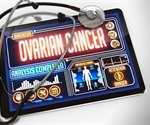 Discovery of a potential oncogene in ovarian cancer